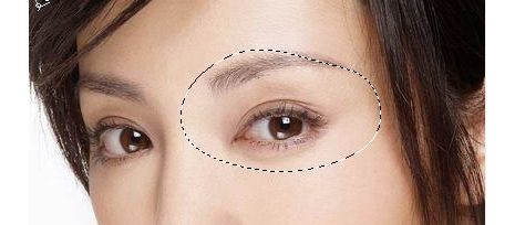 成都米蘭柏羽盧尚兵雙眼皮是否有效？美杜莎美眼術(shù)技術(shù)真如傳說(shuō)中那么神奇？