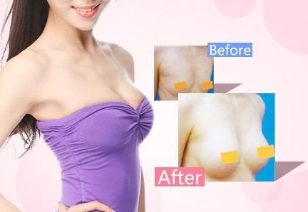 天津哪家醫(yī)院去疤痕好？專業(yè)醫(yī)生推薦的天津去疤痕頂級醫(yī)院有哪些？