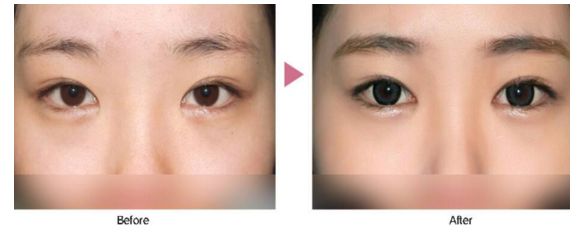 珠海整形醫(yī)院去哪家好？挑選術(shù)前評價好的整形醫(yī)院，放心修復(fù)您的美麗