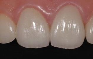 2023武漢面部負(fù)壓吸脂前10位醫(yī)生口碑榜(陜聲國(guó)、楊斐、汪蒙霞實(shí)力口碑樣樣不差)