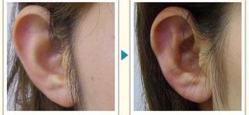 成都燒傷整形醫(yī)院哪家好？燒傷康復(fù)中心排名TOP5，專家支招！