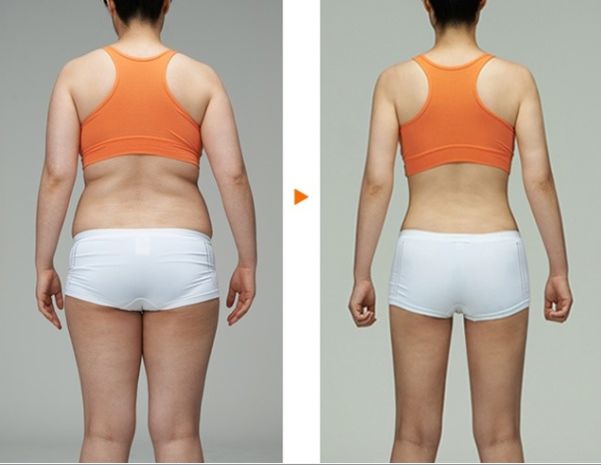 南京吸脂瘦臉哪家醫(yī)院好？全面解析南京吸脂手術(shù)的醫(yī)院排名及選擇攻略