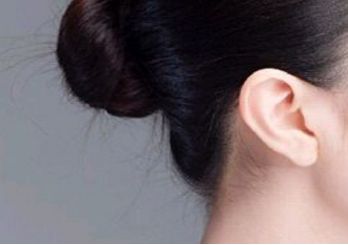 王東脂肪填充是一個(gè)好的選擇嗎？看看口碑和醫(yī)生簡(jiǎn)介的實(shí)例技術(shù)吧！坐診北京藝美讓你信心倍增