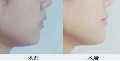 鄭州鼻綜合哪家醫(yī)院好？TOP醫(yī)療機構(gòu)大揭秘