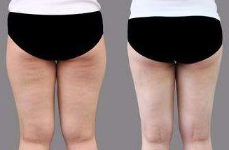 菏澤市整形醫(yī)院哪家好？排名榜單發(fā)布