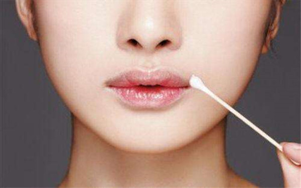 2023廣州除皺針去木偶紋正規(guī)醫(yī)生評(píng)分TOP10(楊權(quán)明、柳霞、丁莉美知名度很高)