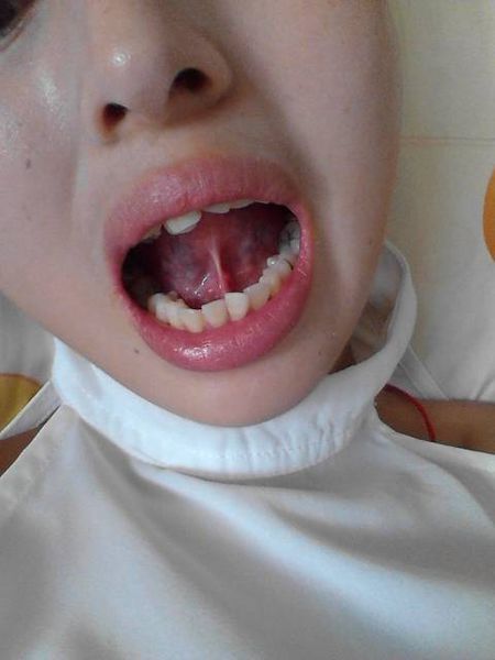 2023寧波botox除皺針權(quán)威專家排行前10強(茅來發(fā)、龔全康、田柏怡技術(shù)特色分享！)