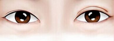 上海哪家醫(yī)院擅長激光治療？