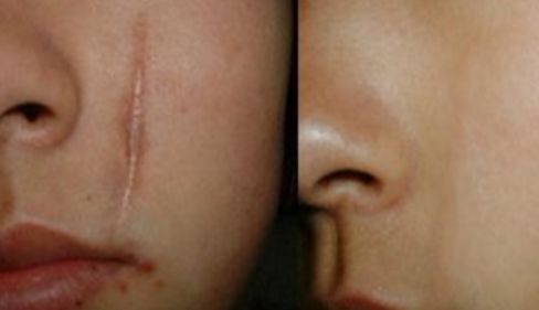 烏魯木齊眼袋手術(shù)專家推薦，哪家醫(yī)院好？