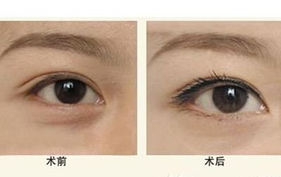 安貞醫(yī)院林煌綜合鼻部整形技術(shù)可信度評(píng)估