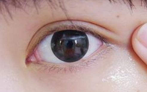 上海激光美白醫(yī)院排行榜及綜合評價(jià)