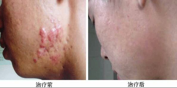 南京哪家醫(yī)院做兔唇手術效果好又安全？