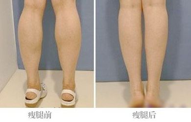 全國激光點(diǎn)痣哪家醫(yī)院好？帶你全面了解最佳選擇！