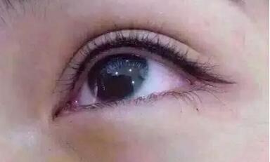 八大處整容醫(yī)院閆言皮膚性病治療的療效如何評(píng)價(jià)？