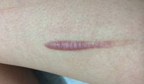 湘潭市美容哪家醫(yī)院好？探尋專家推薦，找到適合你的醫(yī)美機(jī)構(gòu)！