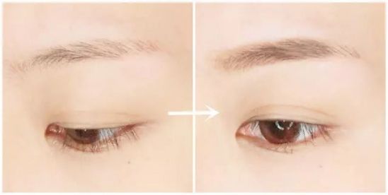 2023蘇州漏斗胸哪里好權(quán)威醫(yī)生排行前十名(樸光哲、張錦錦、張悅迪手術(shù)效果網(wǎng)評(píng)真不錯(cuò))