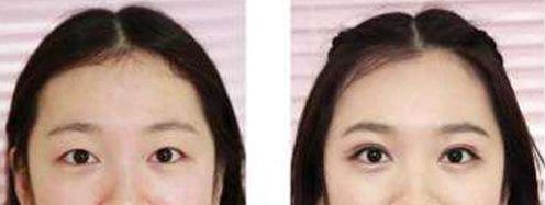 長沙整形科醫(yī)院排名及綜合評價：長沙哪家整形醫(yī)院口碑好？