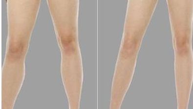 南京埋線醫(yī)院哪家好？權威專家推薦五家頂級醫(yī)院！