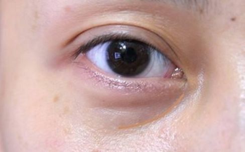 聊城豐胸整形醫(yī)院哪家好？解析引領(lǐng)聊城整形界的最佳選擇