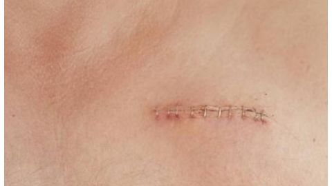 江蘇省中醫(yī)院整形科是否有專業(yè)資質(zhì)？醫(yī)生擅長哪些項目？簡介了解一下！