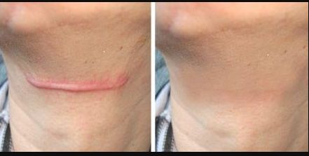 南京取出奧美定哪家好？南京市區(qū)有哪些口碑較好的奧美取出門(mén)店？