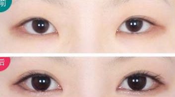 西安治療瘢痕哪家醫(yī)院好評不斷！