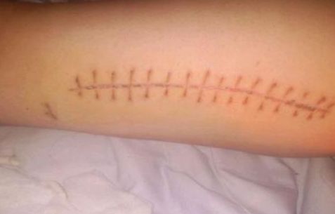 常熟哪家看痘痘醫(yī)院好？專(zhuān)家推薦常熟治療痘痘靠譜的醫(yī)院有哪些？