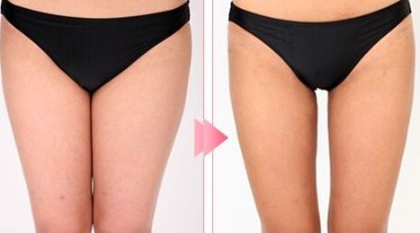 廊坊去斑的醫(yī)院哪家好？推薦您去哪家專業(yè)的醫(yī)院進(jìn)行去斑治療