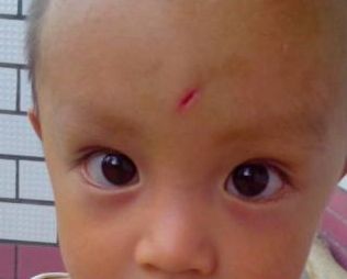 青島童顏線雕提升哪家好？選擇最佳青島童顏線雕醫(yī)院的3個(gè)關(guān)鍵因素