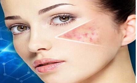 南京哪家醫(yī)院做埋線雙眼皮效果好？