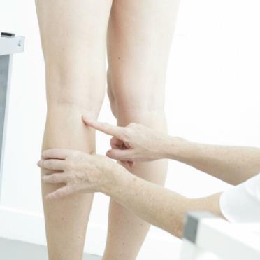 南方醫(yī)院的孫鳳陽教授如何實施正畸矯正及收費展示