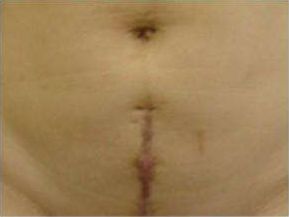 天津祛痘醫(yī)院哪家效果好？為您推薦天津?qū)I(yè)祛痘醫(yī)院排行榜