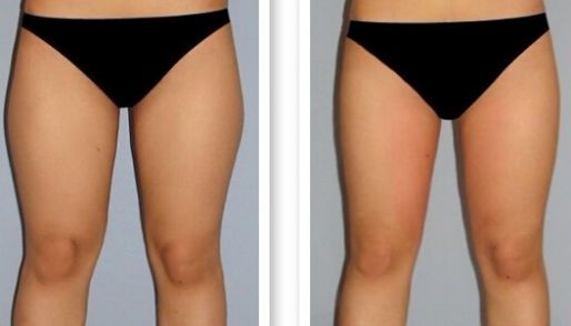 濟(jì)南祛痘哪家醫(yī)院技術(shù)好？選擇哪家醫(yī)院更靠譜？