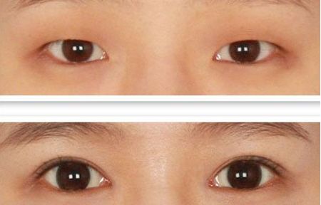 北京整容科好的醫(yī)院有哪些？中關(guān)村整形醫(yī)院綜合實(shí)力領(lǐng)先！