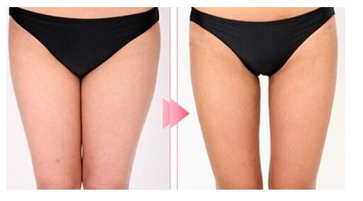 福州整形醫(yī)院哪個(gè)好口碑更佳？