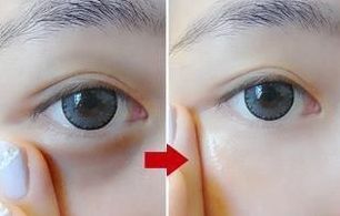 西安微整醫(yī)院排行榜2023：哪家最好？