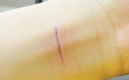 上海哪家隆鼻醫(yī)院好且正規(guī)？?jī)?yōu)質(zhì)咨詢幫助你挑選合適的醫(yī)院