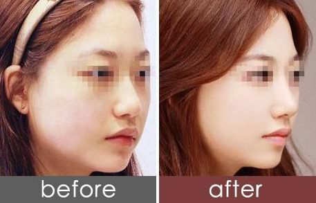 南京皮膚整形醫(yī)院排名及綜合評(píng)價(jià)，哪家好？