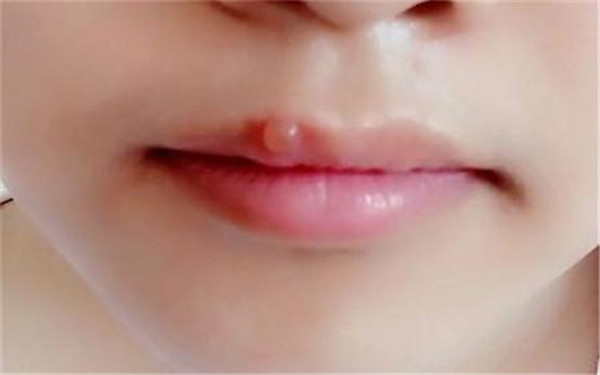 2023石家莊剝離眉間紋正規(guī)專家排名榜前十(方克明、鄭鳳蘭、張學(xué)雷專家實力大PK)