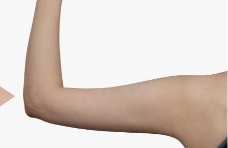 周柯做鼻子的效果及費(fèi)用分析，醫(yī)生介紹與真實(shí)案例揭秘，打造自然又美觀的風(fēng)格