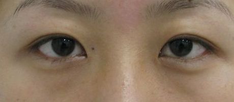 南寧哪家美容整形醫(yī)院口碑好又實(shí)惠？