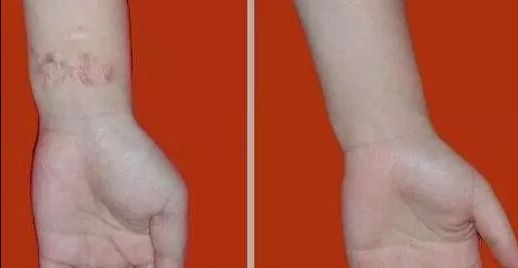 杭州哪家醫(yī)院看喉嚨好？排名最好的專(zhuān)業(yè)醫(yī)院推薦