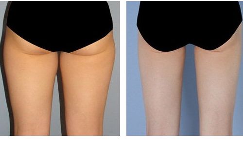 重慶康美整形美容醫(yī)院門診有用戶好評嗎？醫(yī)生資料和價格表全面解讀