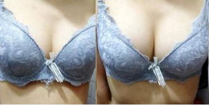 上饒雙眼皮手術(shù)哪家醫(yī)院好？專業(yè)排名推薦！