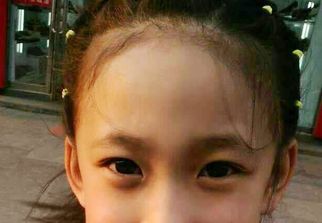 蘇州激光祛疤哪家醫(yī)院好？選擇激光祛疤專(zhuān)家，恢復(fù)美肌無(wú)憂(yōu)！