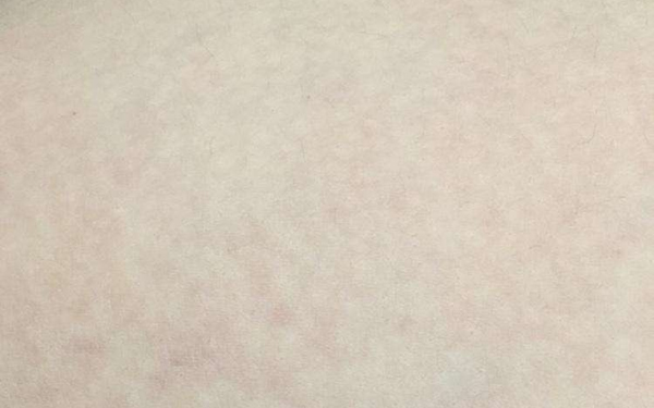 大連哪位醫(yī)生在顴骨整形方面?zhèn)涫懿毮浚筷P(guān)注的5位專家包括關(guān)世超、張東、蔡軍。