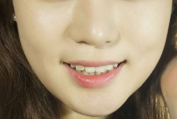 廣州集美醫(yī)療美容怎么樣？廣州集美醫(yī)療美容簡介|醫(yī)生團(tuán)隊|口碑評價！