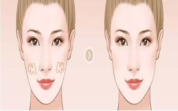 上海雙眼皮埋線醫(yī)院排名及專家推薦：哪家醫(yī)院最好？