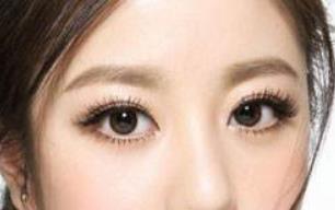 2023益陽SMAS面部提升術(shù)正規(guī)專家排行10強(蔣友寧、吳自強、邱敏這幾個專家真不錯！)