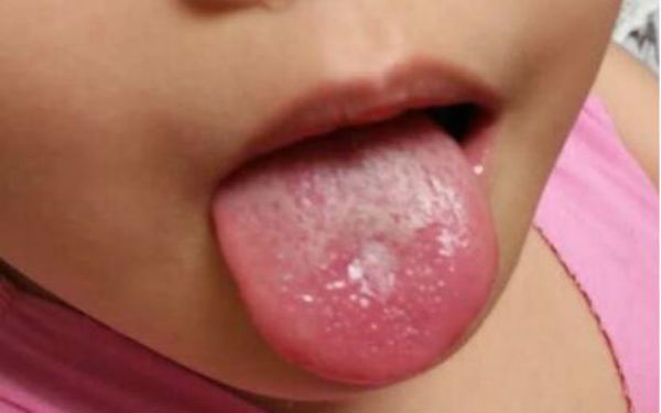 2023貴陽(yáng)手術(shù)切除額頭紋專家口碑榜前10名(徐春佳、朱鴻雁、余升原口碑優(yōu)異，速覽~)